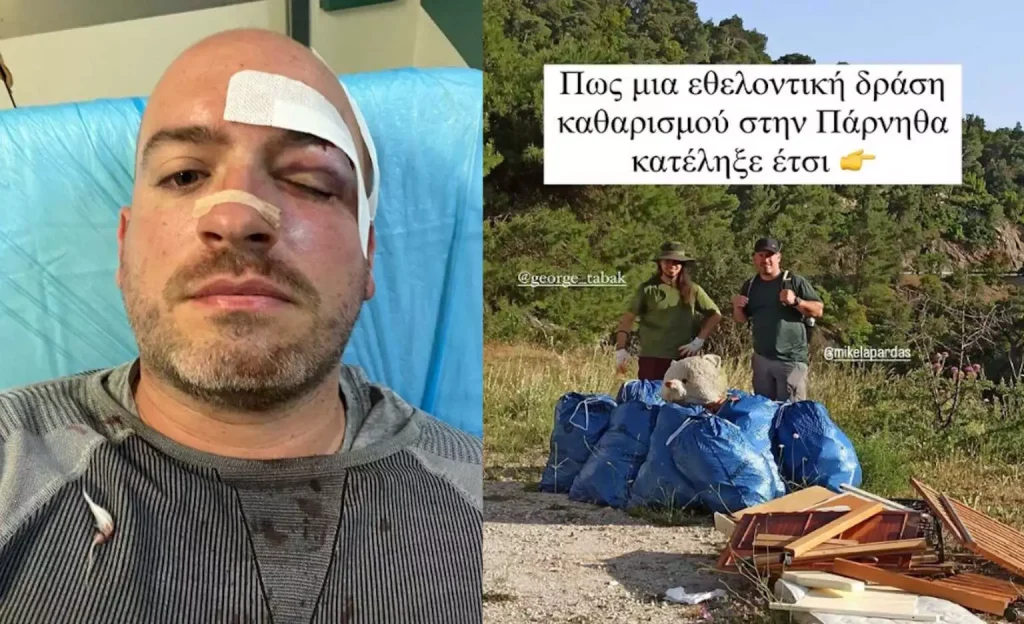 Πάρνηθα: Σοκάρει η αναίτια επίθεση με μαχαίρια σε εθελοντές – «Τους έσωσα με σακούλες σκουπιδιών», λέει αυτόπτης μάρτυρας(βίντεο)