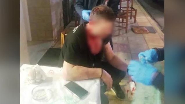 Αγρίνιο: Θύμα άγριου ξυλοδαρμού επιχειρηματίας από πελάτες επειδή δεν τους άρεσε το φαγητό!